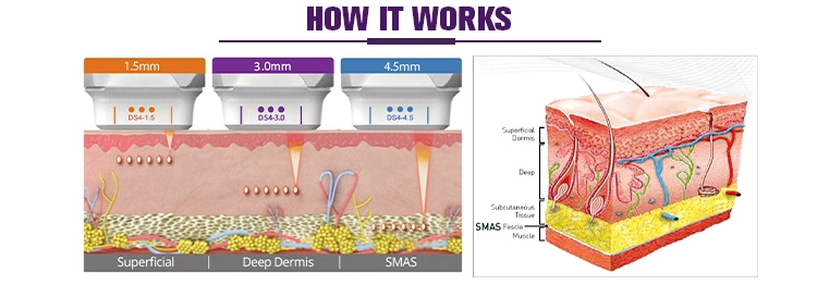 Professional Body High Intensity Focused Ultrasound Skin Care Slimming Beauty Medical Equipment